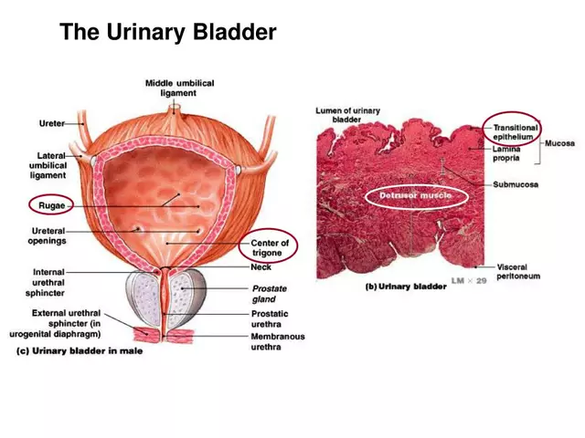How to cope with bladder and urinary incontinence symptoms during travel